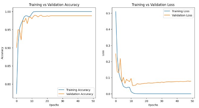 Klasifikasi Jenis Alas Kaki dengan Convolutional Neural Networks (CNN)